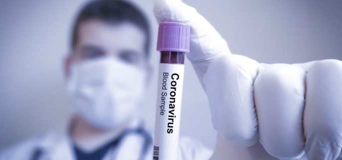 test-coronavirus-1068x797